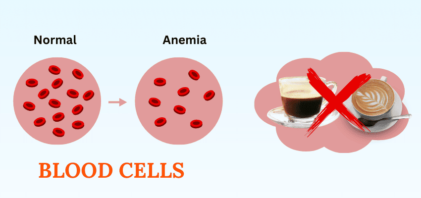 Anemia